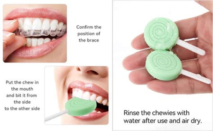 Are chewies necessary for Invisalign?