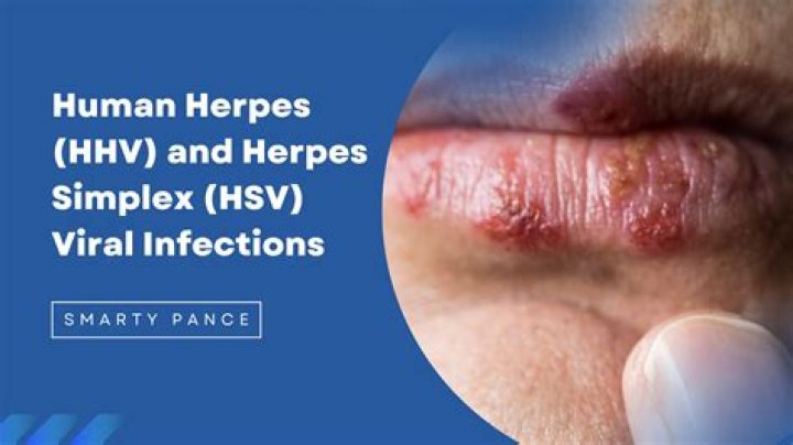 Can HHV-6 be cured?
