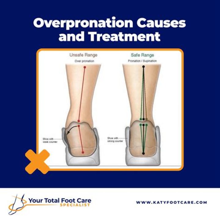 Do insoles help with pronation?