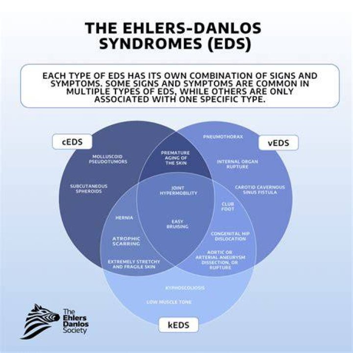 Does EDS cause brain lesions?