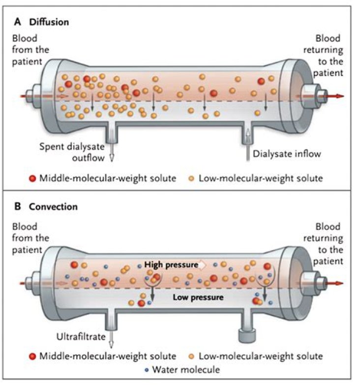 How big is a Dialyser?