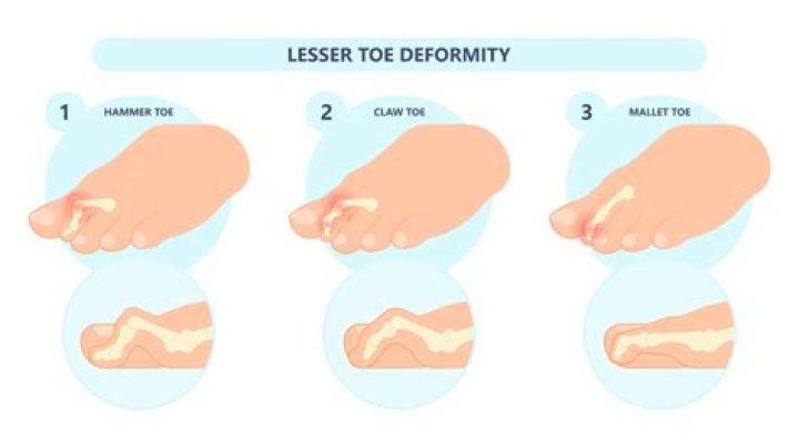 How do I fix my heavy legs?