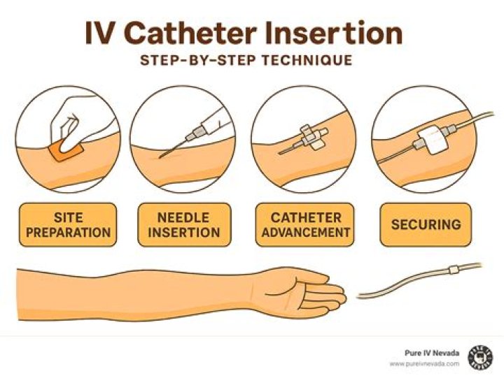 How do you administer Ancef IV?