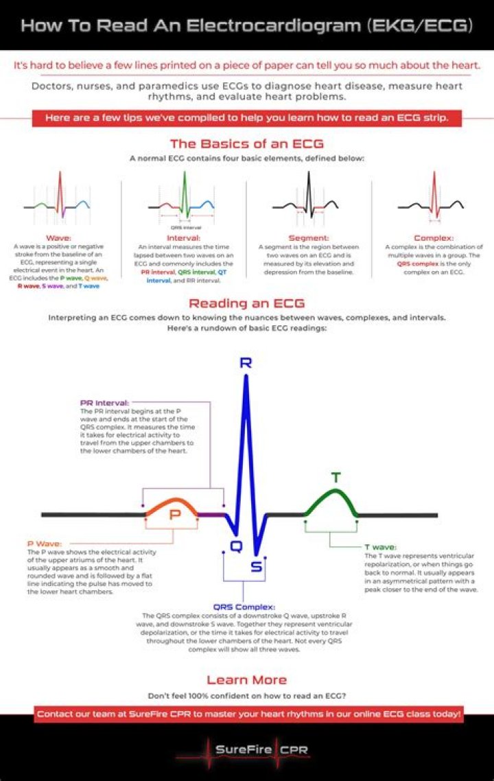 How do you read a fetal EKG?