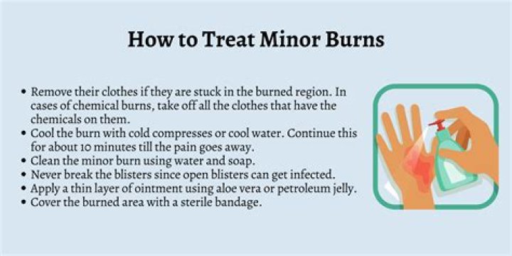 How do you treat winter burn?