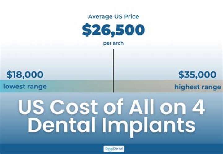 How much does it cost to replace all your teeth?