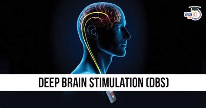 Is deep brain stimulation available in Canada?