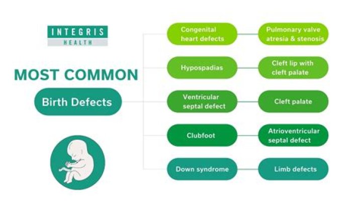 What are the most common birth defects?