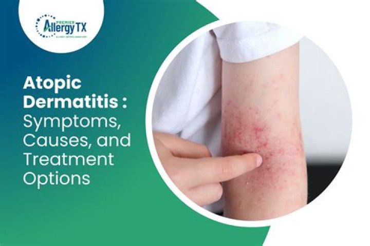 What does Acrodermatitis Chronica Atrophicans look like?