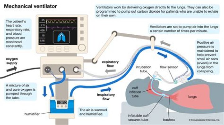 What is screening in mechanical operation?