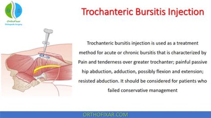 Where do they inject for hip bursitis?
