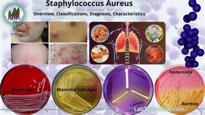 Where is Staphylococcus Schleiferi found?