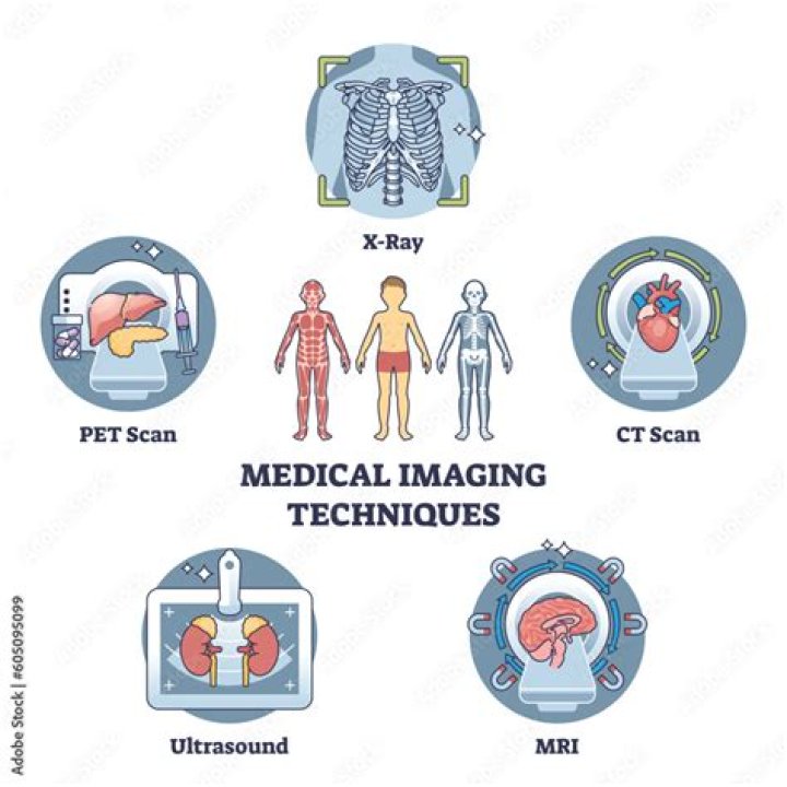 Which imaging technique is best for diagnosing a concussion?